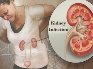 How to Know If Your Kidney Is Infected: Signs and Symptoms